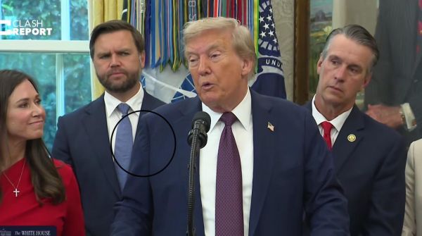 Грозит ампутация руки: раскрыт опасный диагноз Трампа